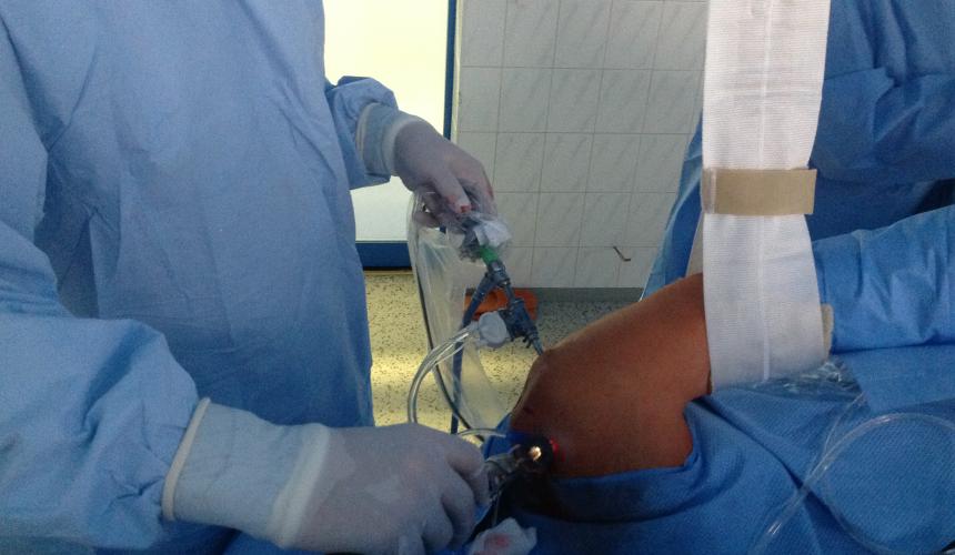 Subakromionálna dekompresia