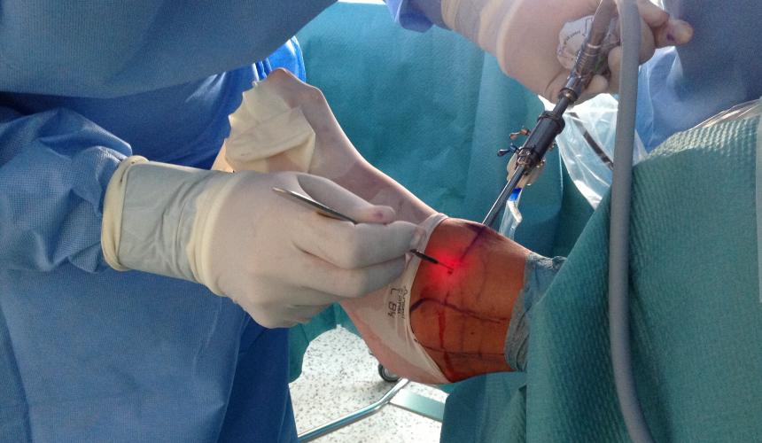 Impingement členkového kĺbu