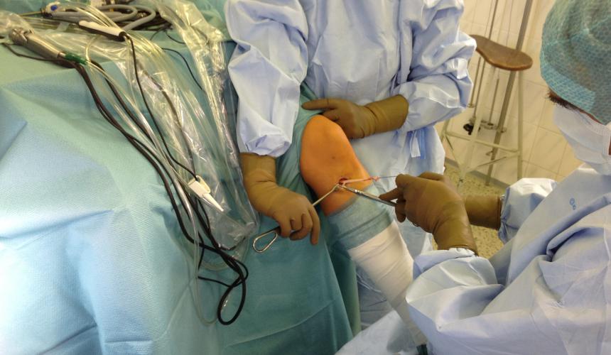 Plastika skríženého väzu STGR